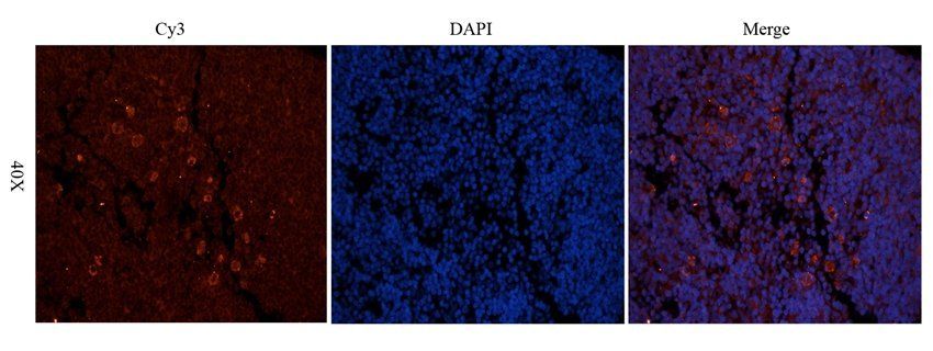 ICAM1 antibody