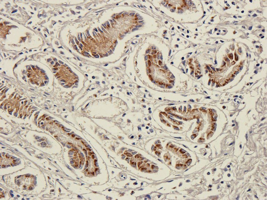 ICAM1 antibody