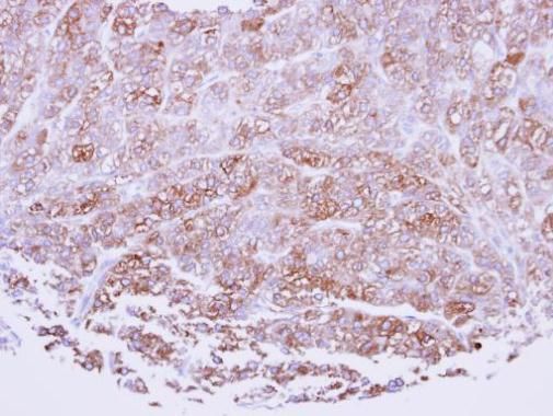 ICAM2 Rabbit Polyclonal Antibody