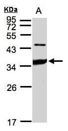 ICAM2 Rabbit Polyclonal Antibody