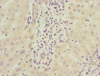 ICAM4 Antibody
