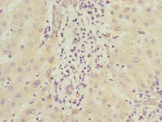 ICAM4 antibody