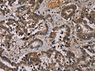 ICAM4 Antibody