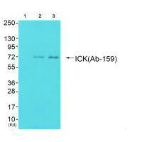 ICK (Ab-159) antibody