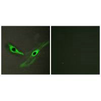 ICK Antibody