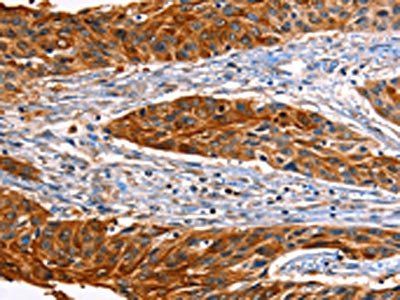 ID4 Antibody