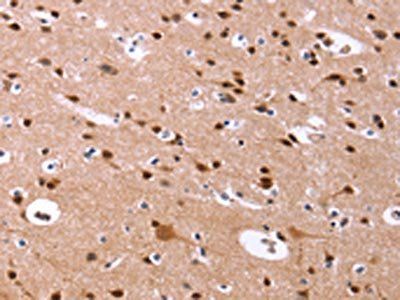 ID4 Antibody