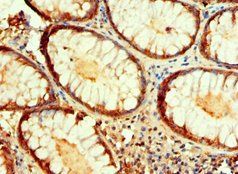 IDH1 Antibody