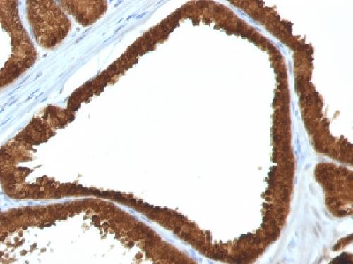 IDH1 (Isocitrate Dehydrogenase) Antibody