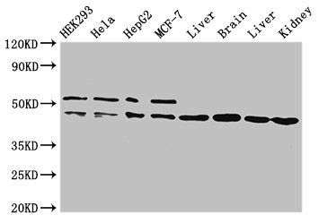 IDH1 Antibody