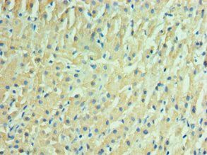 IDH2 Antibody