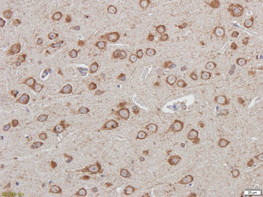 IDH2 antibody