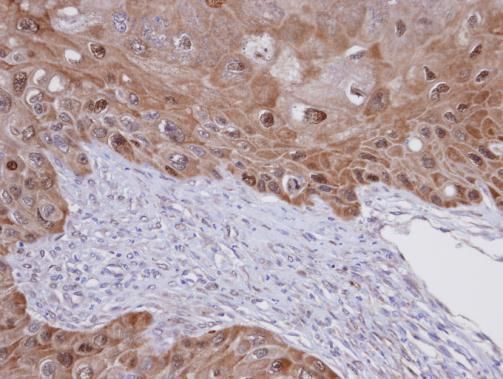 IDI1 Rabbit Polyclonal Antibody