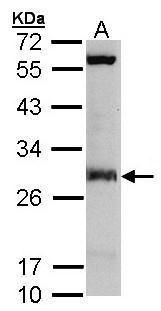 IDI1 Rabbit Polyclonal Antibody