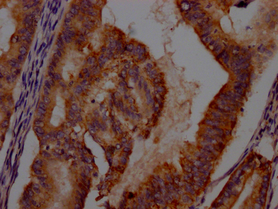IDO1 Recombinant Monoclonal Antibody