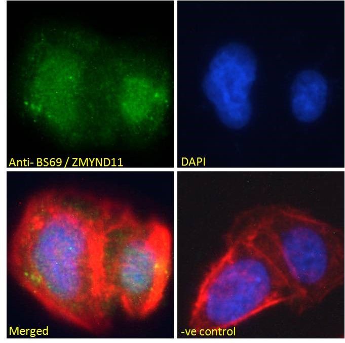 Goat anti-BS69 / ZMYND11 Antibody