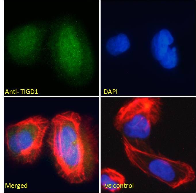 TIGD1 antibody