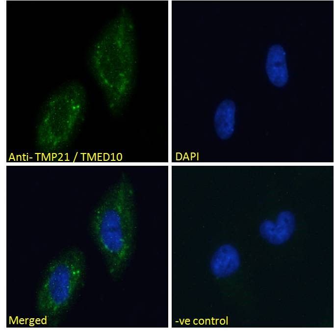 Goat anti-TMP21 / TMED10 Antibody