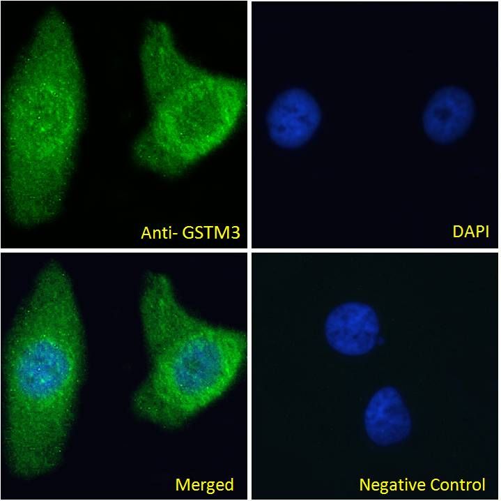Goat anti-GSTM3 Antibody