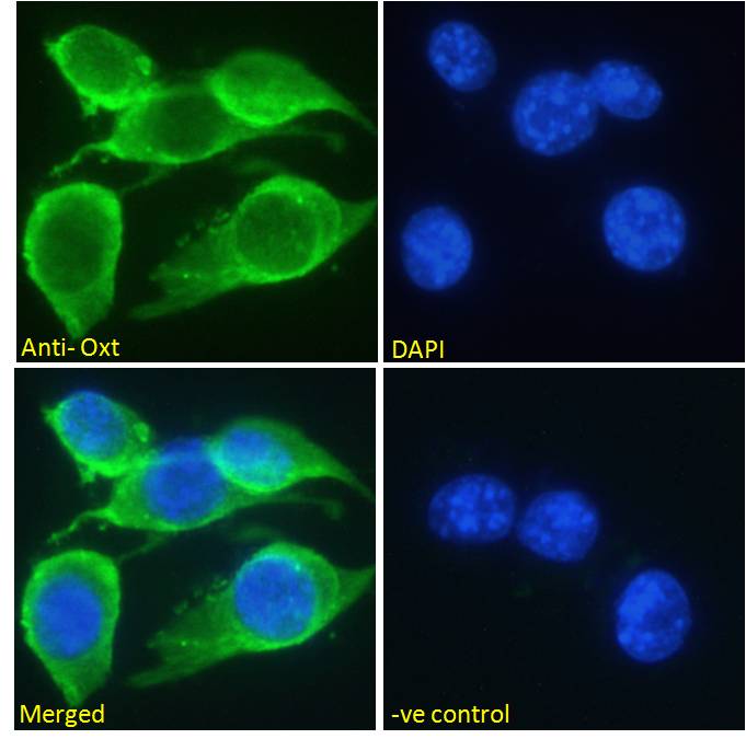 Oxytocin antibody