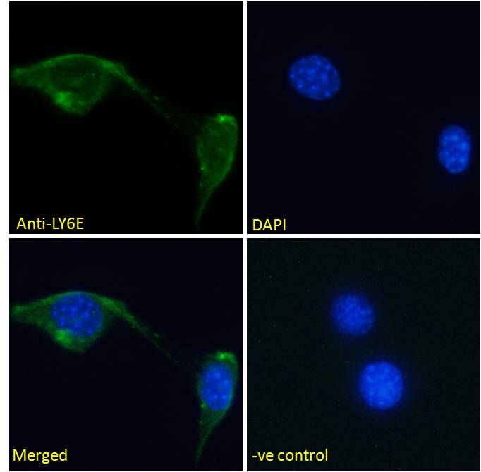 LY6E antibody