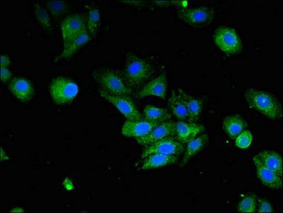 IFI44L antibody