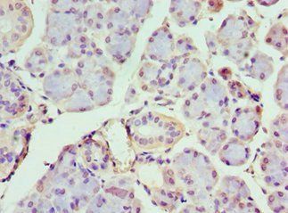 IFIH1 Antibody