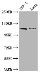 IFIH1 Recombinant Monoclonal Antibody