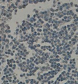 IFIH1 Rabbit Polyclonal Antibody