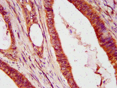 IFIT2 Antibody