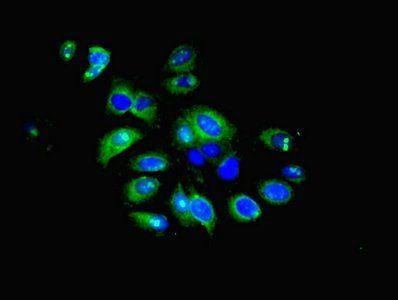 IFIT5 Antibody