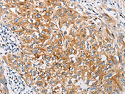 IFITM3 Antibody