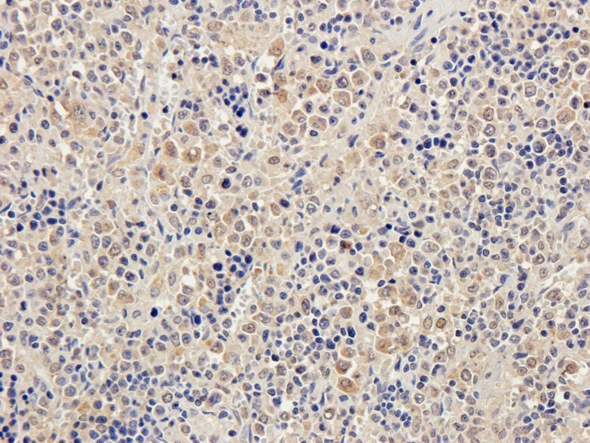 IFN alpha antibody