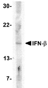 IFN-beta Antibody