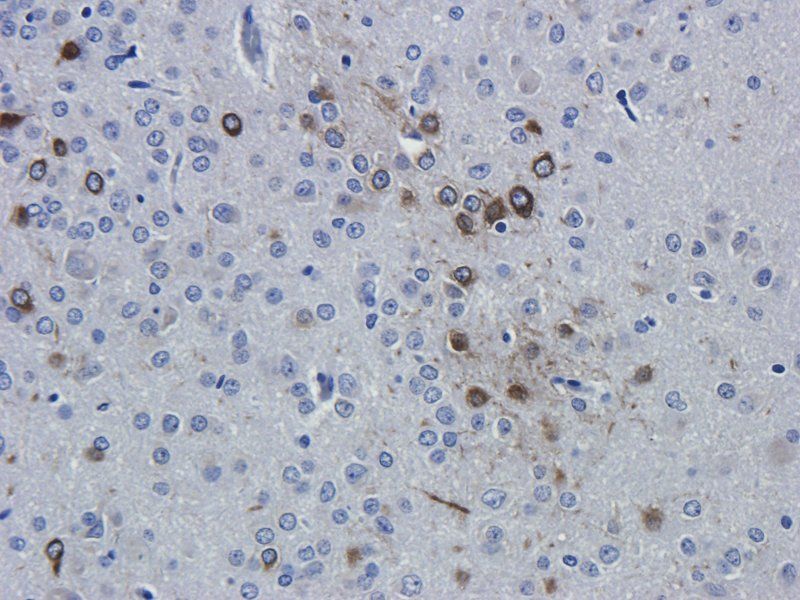 Interferon gamma antibody