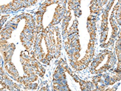 IFNA2 antibody