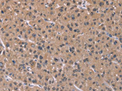 IFNA2 Antibody