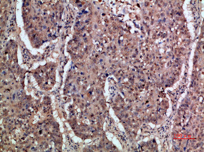 IFNAR1 antibody