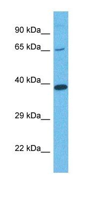 IFNAR2 antibody