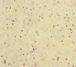 IFNAR2 Antibody