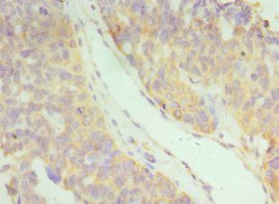 IFNAR2 Antibody
