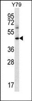 IFNGR1 antibody