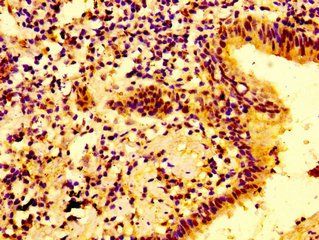 IFNGR2 Antibody