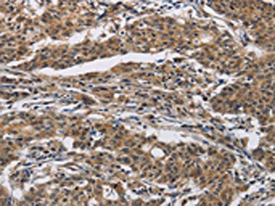 IFNGR2 Antibody