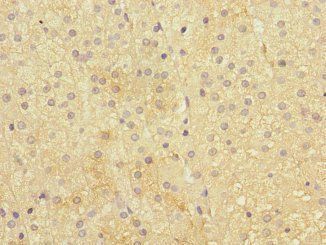 IFNLR1 Antibody