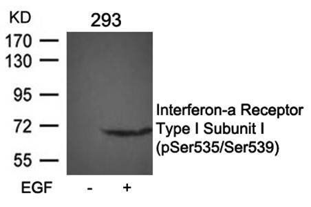 Interferon-a Receptor Type I Subunit I (phospho-Ser535/Ser539) Antibody