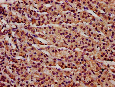IFT140 Antibody