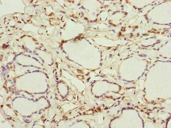 IFT20 antibody