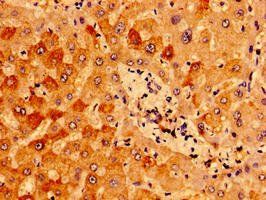 IFT46 Antibody