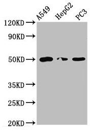 IFT52 antibody